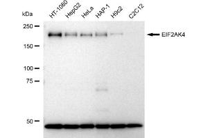 Western blotting analysis using EIF2AK4 antibody (ABIN7798505). (Recombinant GCN2 antibody)