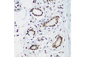 Immunohistochemistry of paraffin-embedded human breast using TriMethyl-Histone H3-K64 antibody (ABIN7267701) at dilution of 1:100 (40x lens). (Histone 3 antibody  (H3K64me3))