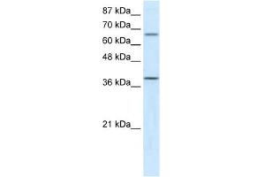 ACADM antibody used at 5 ug/ml to detect target protein. (Medium-Chain Specific Acyl-CoA Dehydrogenase, Mitochondrial (N-Term) antibody)