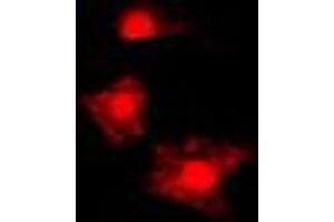 Immunofluorescent analysis of FAST Kinase staining in HL60 cells. (FASTK antibody  (Center))