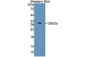 Western blot analysis of the recombinant protein. (Acetyl-CoA Carboxylase beta antibody  (AA 29-249))