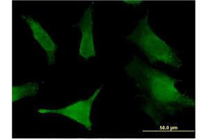Immunofluorescence of monoclonal antibody to SLC6A16 on HeLa cell. (SLC6A16 antibody  (AA 406-492))