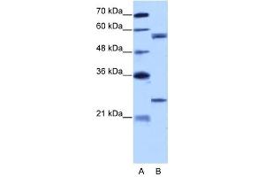 Copine I antibody used at 5 ug/ml to detect target protein.