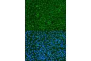 Immunofluorescence analysis of U2OS cells using YWHAZ antibody. (14-3-3 zeta antibody  (C-Term))