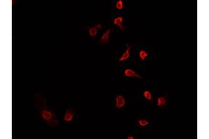 ABIN6278079 staining HepG2? (MBD1 antibody  (C-Term))