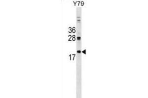 Western Blotting (WB) image for anti-DnaJ (Hsp40) Homolog, Subfamily C, Member 5 (DNAJC5) antibody (ABIN2999623)