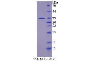 Image no. 1 for Growth Factor Receptor-Bound Protein 14 (GRB14) (AA 264-538) protein (His tag) (ABIN5665283) (GRB14 Protein (AA 264-538) (His tag))