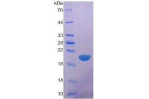 SDS-PAGE analysis of Human Glypican 1 Protein.