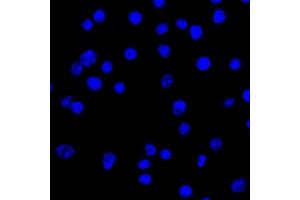 Confocal Immunofluorescent analysis of Ramos cells using CF488-labeled Isotype Control Monoclonal Antibody (IgG2a) (Green).