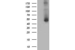Western Blotting (WB) image for anti-Golgi Membrane Protein 1 (GOLM1) antibody (ABIN1498498) (GOLM1 antibody)