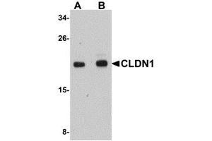 Western blot analysis of CLDN1 in HepG2 cell lysate with AP30236PU-N CLDN1 antibody at (A) 1 and (B) 2 μg/ml.