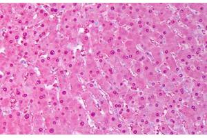 Anti-SOD1 antibody IHC staining of human liver, hephatocytes. (SOD1 antibody)