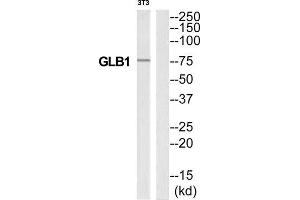 Western Blotting (WB) image for anti-Galactosidase, beta 1 (GLB1) (Internal Region) antibody (ABIN1850915) (GLB1 antibody  (Internal Region))