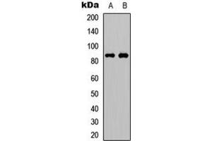 Western blot analysis of FRS2 (pY436) expression in Jurkat (A), Huvec (B) whole cell lysates.