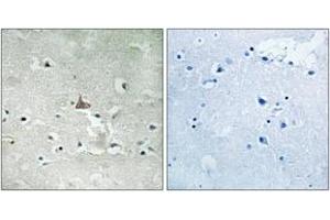 Immunohistochemistry analysis of paraffin-embedded human brain, using Trk B (Phospho-Tyr706+Tyr707) Antibody.