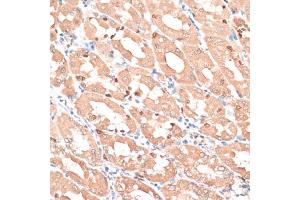 Immunohistochemistry of paraffin-embedded human stomach using HMGA1 antibody. (HMGA1 antibody)