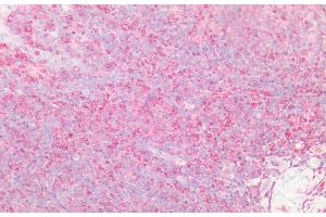 Detection of PTPN2 in Human Tonsil Tissue using Polyclonal Antibody to Protein Tyrosine Phosphatase, Non Receptor Type 2 (PTPN2) (PTPN2 antibody  (AA 1-257))