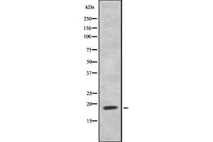Western blot analysis of HEN1/2 using Jurkat whole cell lysates (HEN1/2 antibody)