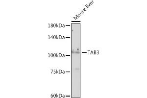 Western blot analysis of extracts of Mouse liver, using T antibody (ABIN7270793) at 1:1000 dilution. (TAB3 antibody)