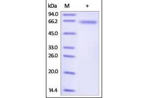Human DLL4, His Tag on SDS-PAGE under reducing (R) condition. (DLL4 Protein (AA 27-524) (His tag))