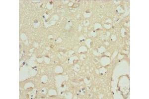 Immunohistochemistry of paraffin-embedded human brain tissue using ABIN7175594 at dilution of 1:100