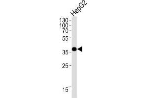 Western Blotting (WB) image for anti-Olfactory Receptor, Family 1, Subfamily L, Member 3 (OR1L3) antibody (ABIN3004734) (OR1L3 antibody)