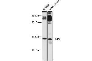 Western blot analysis of extracts of various cell lines, using NPB antibody (ABIN7268885) at 1:1000 dilution. (Neuropeptide B antibody  (AA 1-125))