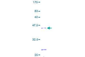 SDHC Protein (AA 1-169) (GST tag)