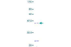 SDHC Protein (AA 1-169) (GST tag)