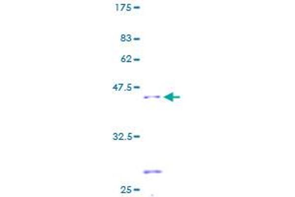 SDHC Protein (AA 1-169) (GST tag)