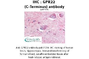 Image no. 1 for anti-G Protein-Coupled Receptor 22 (GPR22) (C-Term), (Cytoplasmic Domain) antibody (ABIN1735032) (GPR22 antibody  (C-Term, Cytoplasmic Domain))