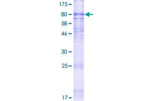 ABCC11 Protein (AA 1-553) (GST tag)