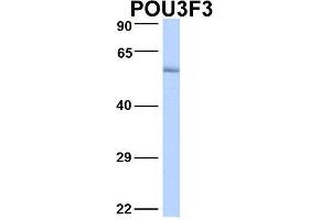 Host:  Rabbit  Target Name:  POU3F3  Sample Type:  Human Fetal Lung  Antibody Dilution:  1. (POU3F3 antibody  (N-Term))