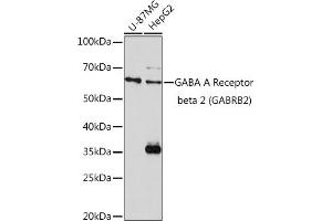 Western Blotting (WB) image for anti-gamma-aminobutyric Acid (GABA) A Receptor, beta 2 (GABRB2) (AA 26-244) antibody (ABIN3015662)