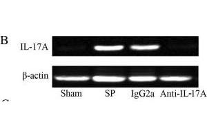 Interleukin 17a antibody