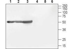 Western blot analysis of rat brain (lanes 1 and 4), mouse brain (lanes 2 and 5) and rat cortex (lane 3 and 6): - 1-3. (CACNB1 antibody  (C-Term, Intracellular))