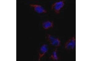 Immunofluorescence analysis of BMP7 antibody and HeLa cells.