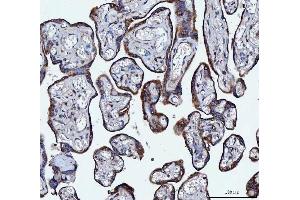 IHC analysis of VAPA using anti-VAPA antibody (ABIN7603249). (VAPA antibody  (N-Term))