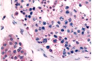 Human Testis (formalin-fixed, paraffin-embedded) stained with GPR18 antibody ABIN213453 at 5 ug/ml followed by biotinylated goat anti-rabbit IgG secondary antibody ABIN481713, alkaline phosphatase-streptavidin and chromogen. (GPR18 antibody  (Cytoplasmic Domain))