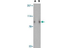 Western blot analysis of SLITRK1 in human brain tissue lysate with SLITRK1 polyclonal antibody  at (A) 1 and (B) 2 ug/mL . (SLITRK1 antibody  (Internal Region))