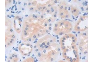 Detection of CECR1 in Human Kidney Tissue using Polyclonal Antibody to Cat Eye Syndrome Chromosome Region, Candidate 1 (CECR1) (CECR1 antibody  (AA 30-511))