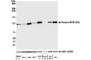 Western Blotting (WB) image for anti-Minichromosome Maintenance Complex Component 2 (MCM2) (pSer53) antibody (ABIN7449430)