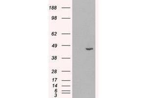 Image no. 1 for anti-Hydroxysteroid (11-Beta) Dehydrogenase 1 (HSD11B1) (C-Term) antibody (ABIN374673) (HSD11B1 antibody  (C-Term))