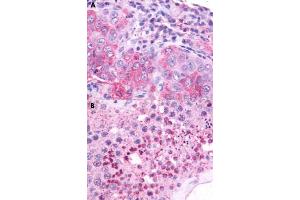 Immunohistochemical staining of formalin-fixed paraffin-embedded human lung (A) and human testis (B) with nMBR polyclonal antibody . (NMBR antibody  (Cytoplasmic Domain))