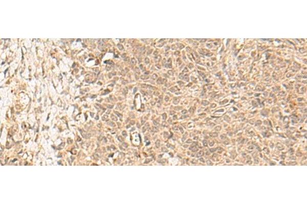 FBXL4 antibody