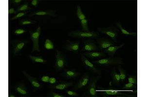 Immunofluorescence of purified MaxPab antibody to WDR79 on HeLa cell.