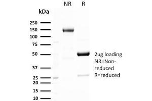 SDS-PAGE Analysis Purified GLUT-1 Recombinant Rabbit Monoclonal Antibody (GLUT1/3132R). (Recombinant GLUT1 antibody  (AA 203-305))