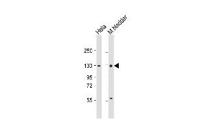 All lanes : Anti-Enpp1 Antibody (N-term) at 1:1000 dilution Lane 1: Hela whole cell lysate Lane 2: mouse bladder lysate Lysates/proteins at 20 μg per lane. (ENPP1 antibody  (N-Term))