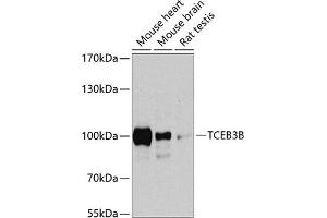 Western blot analysis of extracts of various cell lines, using TCEB3B antibody  at 1:1000 dilution. (TCEB3B antibody  (AA 534-753))