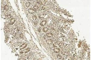 Immunohistochemical analysis of paraffin-embedded Human Small intestine section using Pink1 (ABIN1539798 and ABIN2843775). (METAP1 antibody)